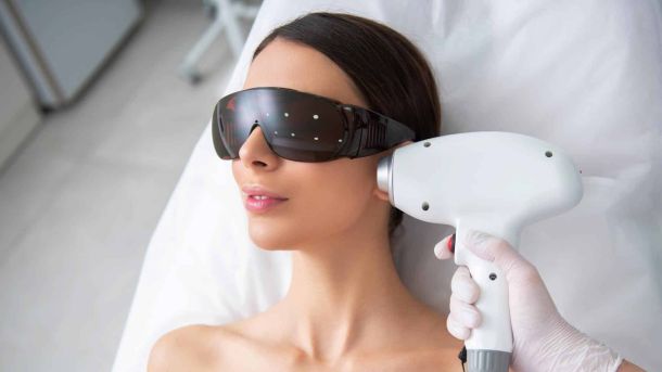 Definitieve ontharing laserbehandeling gezicht bakkebaarden vrouw Laserstudio Noord
