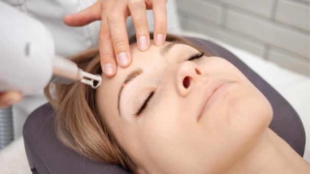 Laserbehandeling gezicht wenkbrauwen vrouwen Laserstudio Noord