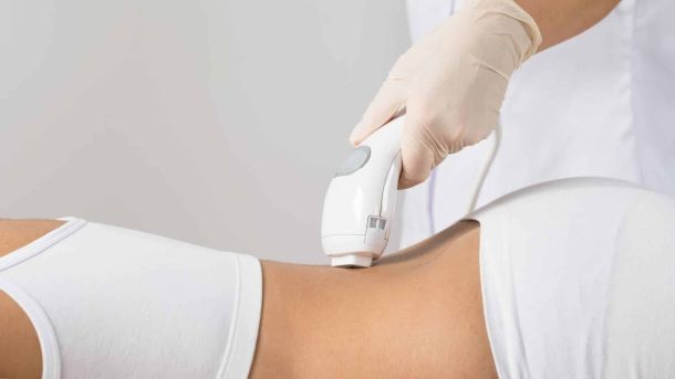 Laserbehandeling definitief ontharen lichaam vrouw onderrug Laserstudio Noord