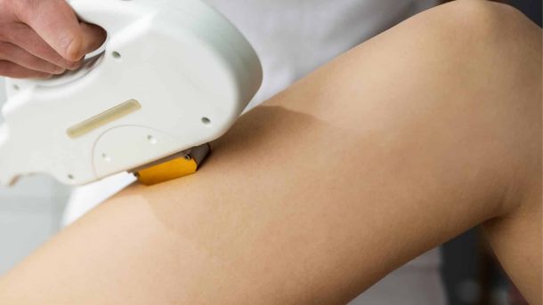 Ontharen laserbehandeling bovenbeen man Laser Studio Noord