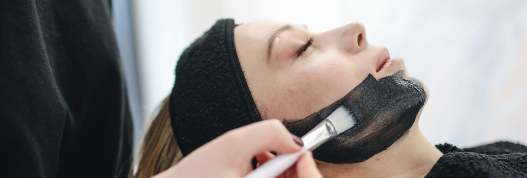 Carbon Laser Peel